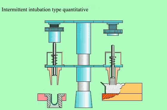 Principe quantitatif du type d'intubation intermittente